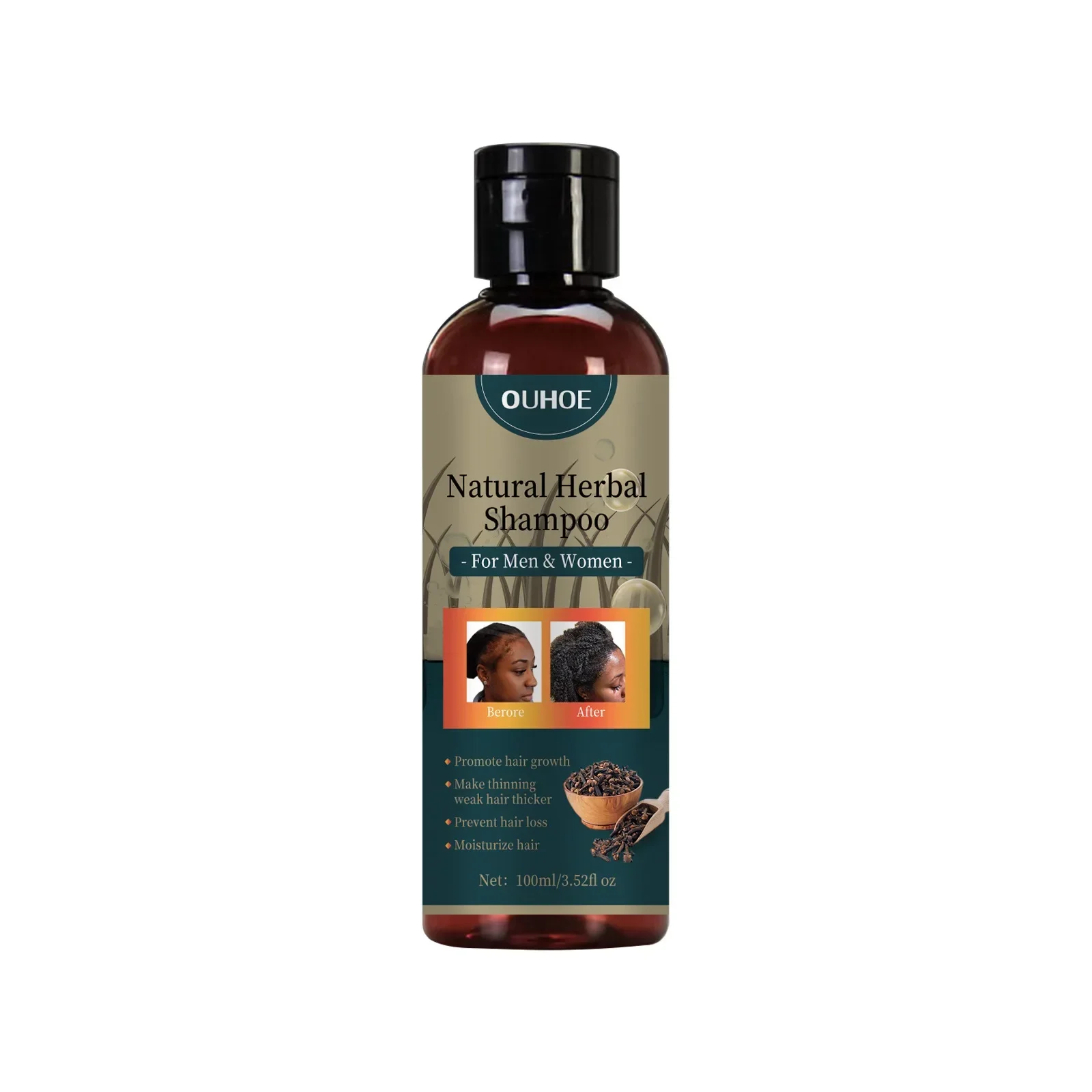 شامبو نمو الشعر من OUHOE، شامب - مراجعة Hair Care Dandruff وسعره