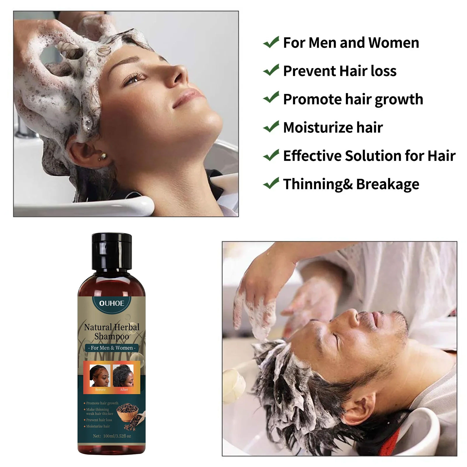 شامبو نمو الشعر من OUHOE، شامب - مراجعة Hair Care Dandruff وسعره