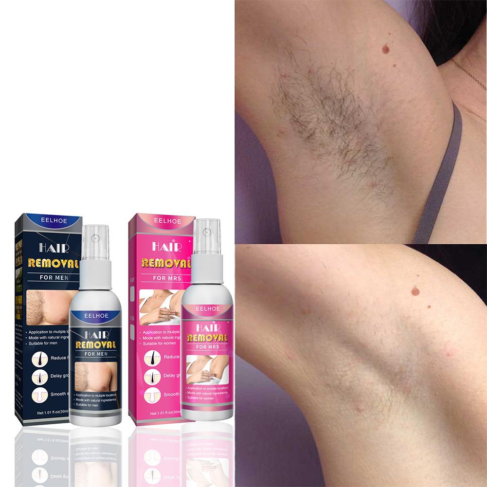1/2 قطعة مزيل الشعر الدائم غير - مراجعة Hair Care China وسعره