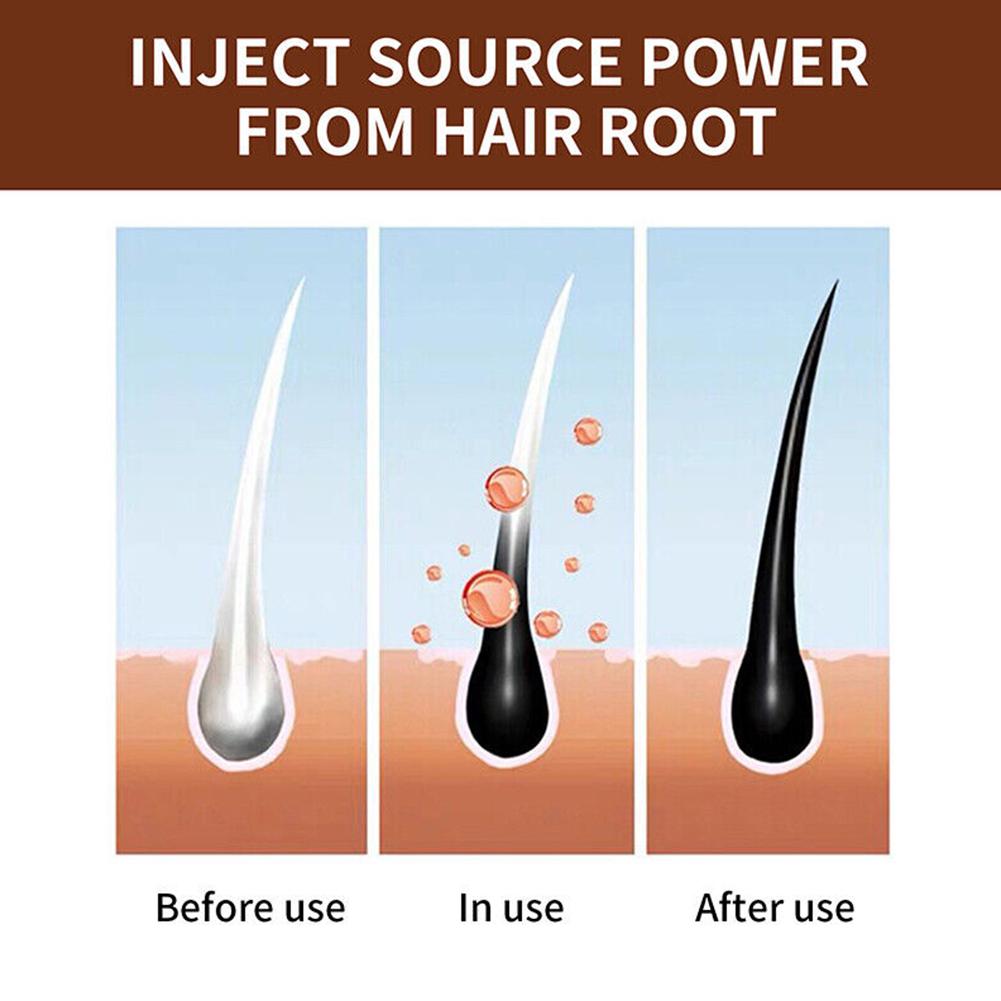صابون البوليغونوم الطبيعي المص - مراجعة Hair Care Dandruff وسعره